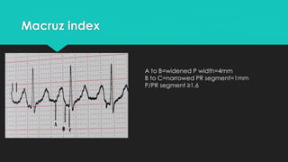 Macruz index

A to B=widened P width=1.6mm
B to C=narrowed PR segment=0.4mm
P/PR segment ≥1.6

 