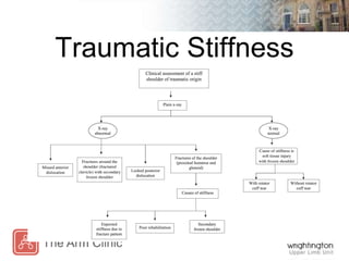 Traumatic Stiffness
 