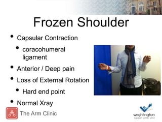 Frozen Shoulder
• Capsular Contraction
• coracohumeral
ligament
• Anterior / Deep pain
• Loss of External Rotation
• Hard ...