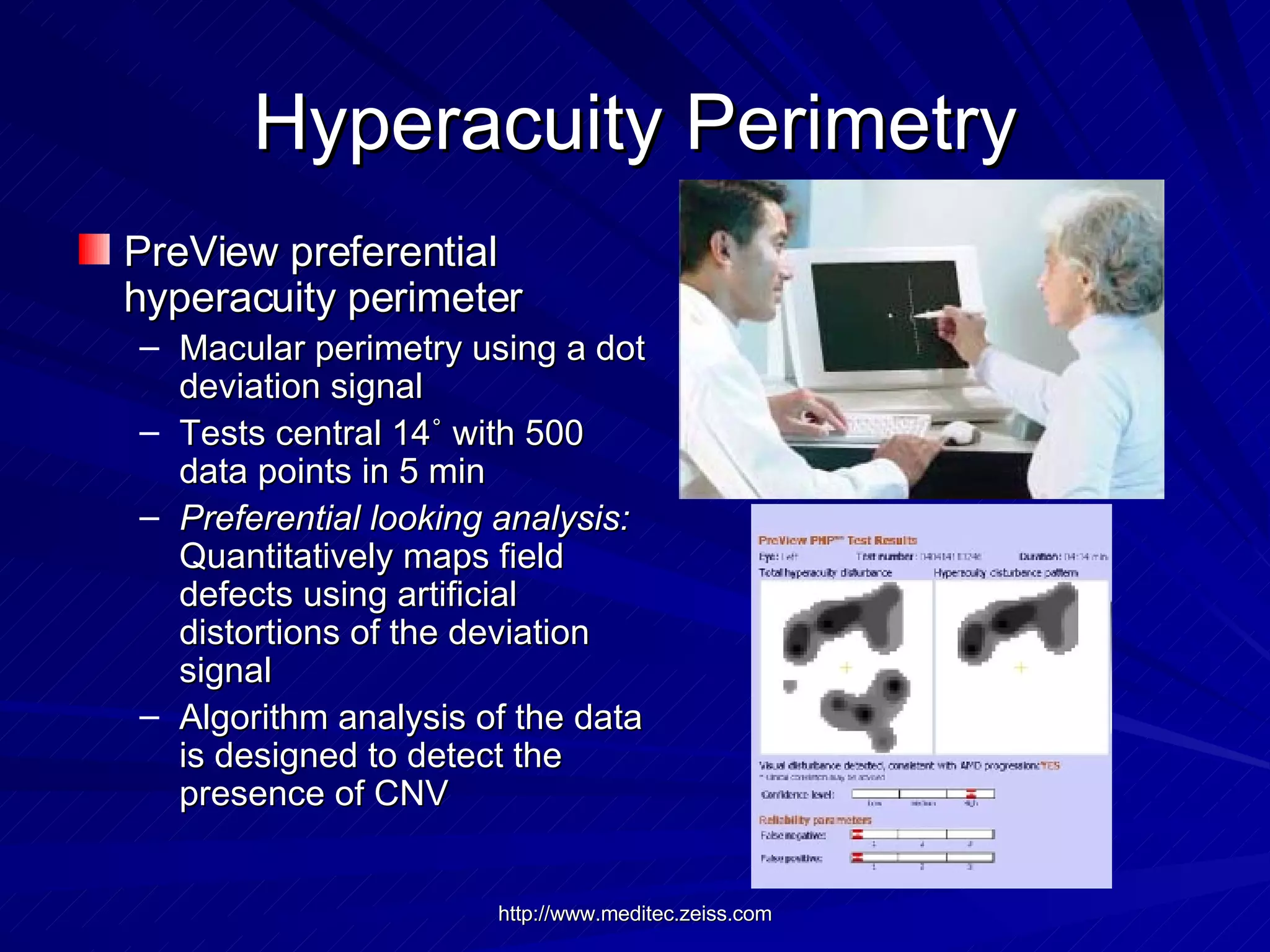 Hyperacuity Perimetry PreView preferential hyperacuity perimeter  Macular perimetry using a dot deviation signal  Tests central 14 ˚ with 500 data points in 5 min Preferential looking analysis:  Quantitatively maps field defects using artificial distortions of the deviation signal  Algorithm analysis of the data is designed to detect the presence of CNV 