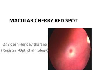 MACULAR CHERRY RED SPOT
Dr.Sidesh Hendavitharana
(Registrar-Opththalmology)
 
