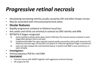 Progressive retinal necrosis
• Devastating necrotizing retinitis,usually caused by VZV and other herpes viruses
• May be associated with immunocompromised states.
• Ocular features
• Rapidly progressive unilateral or bilateral visual loss.
• Ant.uveitis and vitritis are minimal,in contrast to CMV retinitis and ARN.
• RETINITIS:3 Stages recognized.
1) Early:multifocal yellow white deep retinal infiltrates.The macula may be involved in early
stage,often giving a cherry red spot.
2) Established/middle:The signs typically spread rapidly around the retina,with extansive full
thickness necrosis.signs of vasculitis are absent or mild,and significant h’age is uncommon.
3) Late:scarring is plaque like and characterized as ‘cracked mud’.RRD is very common,as in
optic atrophy.
• Investigation:
• Vitrious/aqueous PCR for viral DNA
• TREATMENT
– Immune rescue with HAART together with aggressive antiviral therapy
– VR surgery for RD
 
