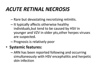ACUTE RETINAL NECROSIS
– Rare but devastating necrotizing retinitis.
– It typically affects otherwise healthy
individuals,but tend to be caused by HSV in
younger and VZV in older pts,other herpes viruses
are suspected.
– Prognosis is relatively poor
• Systemic features:
– ARN has been reported following and occurring
simultaneously with HSV encephalitis and herpetic
skin infection
 