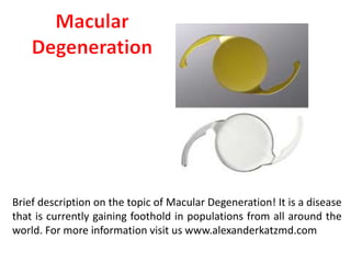 Brief description on the topic of Macular Degeneration! It is a disease
that is currently gaining foothold in populations from all around the
world. For more information visit us www.alexanderkatzmd.com
 