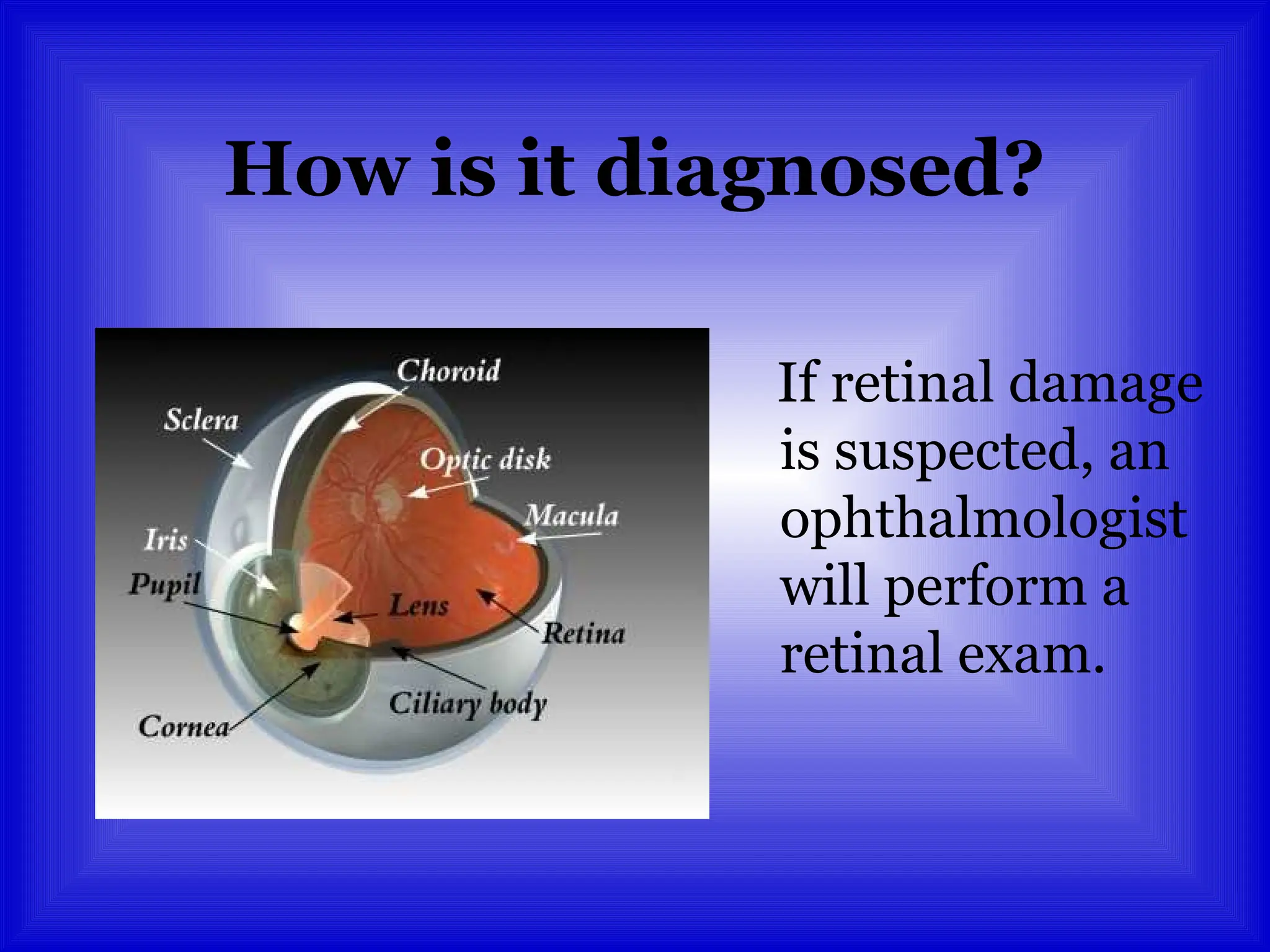 How is it diagnosed?
If retinal damage
is suspected, an
ophthalmologist
will perform a
retinal exam.
 
