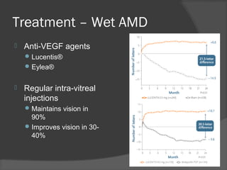 Treatment – Wet AMD
 Anti-VEGF agents
Lucentis®
Eylea®
 Regular intra-vitreal
injections
Maintains vision in
90%
Improves vision in 30-
40%
 