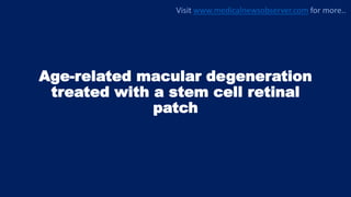 Age-related macular degeneration
treated with a stem cell retinal
patch
Visit www.medicalnewsobserver.com for more..
 