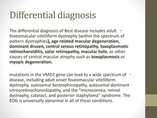 Best Disease Differential Diagnosis