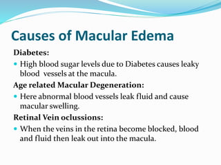 Causes of Macular Edema
Diabetes:
 High blood sugar levels due to Diabetes causes leaky
blood vessels at the macula.
Age related Macular Degeneration:
 Here abnormal blood vessels leak fluid and cause
macular swelling.
Retinal Vein oclussions:
 When the veins in the retina become blocked, blood
and fluid then leak out into the macula.
 
