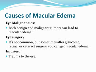 Causes of Macular Edema
Eye Malignancies:
 Both benign and malignant tumors can lead to
macular edema.
Eye surgery:
 It’s not common, but sometimes after glaucome,
retinal or cataract surgery, you can get macular edema.
Injuries:
 Trauma to the eye.
 