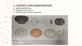 2. CONTACT LENS BIOMICROSCOPY
a. Modified KOEPPE lens
b. Goldmann’s three mirror
c. Panfundoscopic indirect contact lens
 