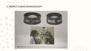 3. INDIRECT FUNDUS BIOMICROSCOPY
 
