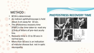 • BCVA is determined.
• An indirect ophthalmoscope is held
about 3 cm away for 10 sec.
• The photostress recovery time
(PSRT) is the time taken to read any
2/3rds of letters of pre–test acuity
line.
• Recovery time is 15 to 30 secs in
normal eyes.
• More than 50 secs is an indication
of macular disease but not in optic
neuropathy.
METHOD :
 