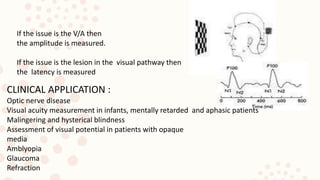 If the issue is the V/A then
the amplitude is measured.
If the issue is the lesion in the visual pathway then
the latency is measured
CLINICAL APPLICATION :
Optic nerve disease
Visual acuity measurement in infants, mentally retarded and aphasic patients
Malingering and hysterical blindness
Assessment of visual potential in patients with opaque
media
Amblyopia
Glaucoma
Refraction
 