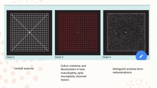 Macular Test Chart