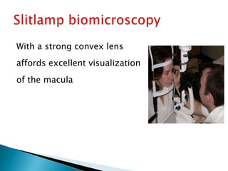 With a strong convex lens
affords excellent visualization
of the macula
 
