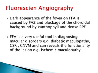    Dark appearance of the fovea on FFA is
    caused by FAZ and blockage of the choroidal
    background by xanthophyll and dense RPE

   FFA is a very useful tool in diagnosing
    macular disorders e.g. diabetic maculopathy,
    CSR , CNVM and can reveals the functionality
    of the lesion e.g. ischemic maculopathy
 