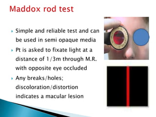    Simple and reliable test and can
    be used in semi opaque media
   Pt is asked to fixate light at a
    distance of 1/3m through M.R.
    with opposite eye occluded
   Any breaks/holes;
    discoloration/distortion
    indicates a macular lesion
 