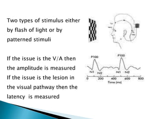 Two types of stimulus either
by flash of light or by
patterned stimuli


If the issue is the V/A then
the amplitude is measured
If the issue is the lesion in
the visual pathway then the
latency is measured
 