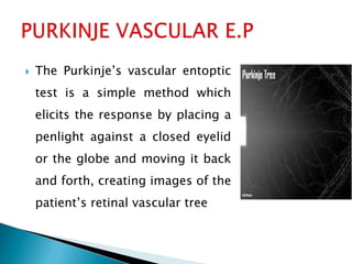   The Purkinje’s vascular entoptic
    test is a simple method which
    elicits the response by placing a
    penlight against a closed eyelid
    or the globe and moving it back
    and forth, creating images of the
    patient’s retinal vascular tree
 