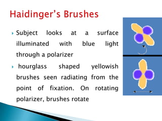    Subject        looks   at    a     surface
    illuminated        with     blue      light
    through a polarizer
   hourglass          shaped        yellowish
    brushes seen radiating from the
    point     of    fixation.   On     rotating
    polarizer, brushes rotate
 