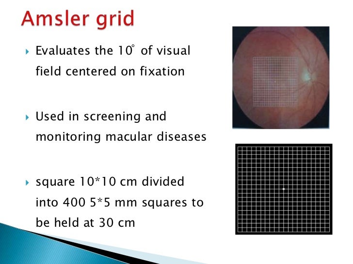 Macular Function Tests