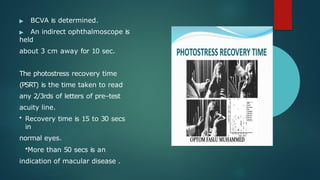 Comprehensive Overview of Macular Function Tests and Clinical ...