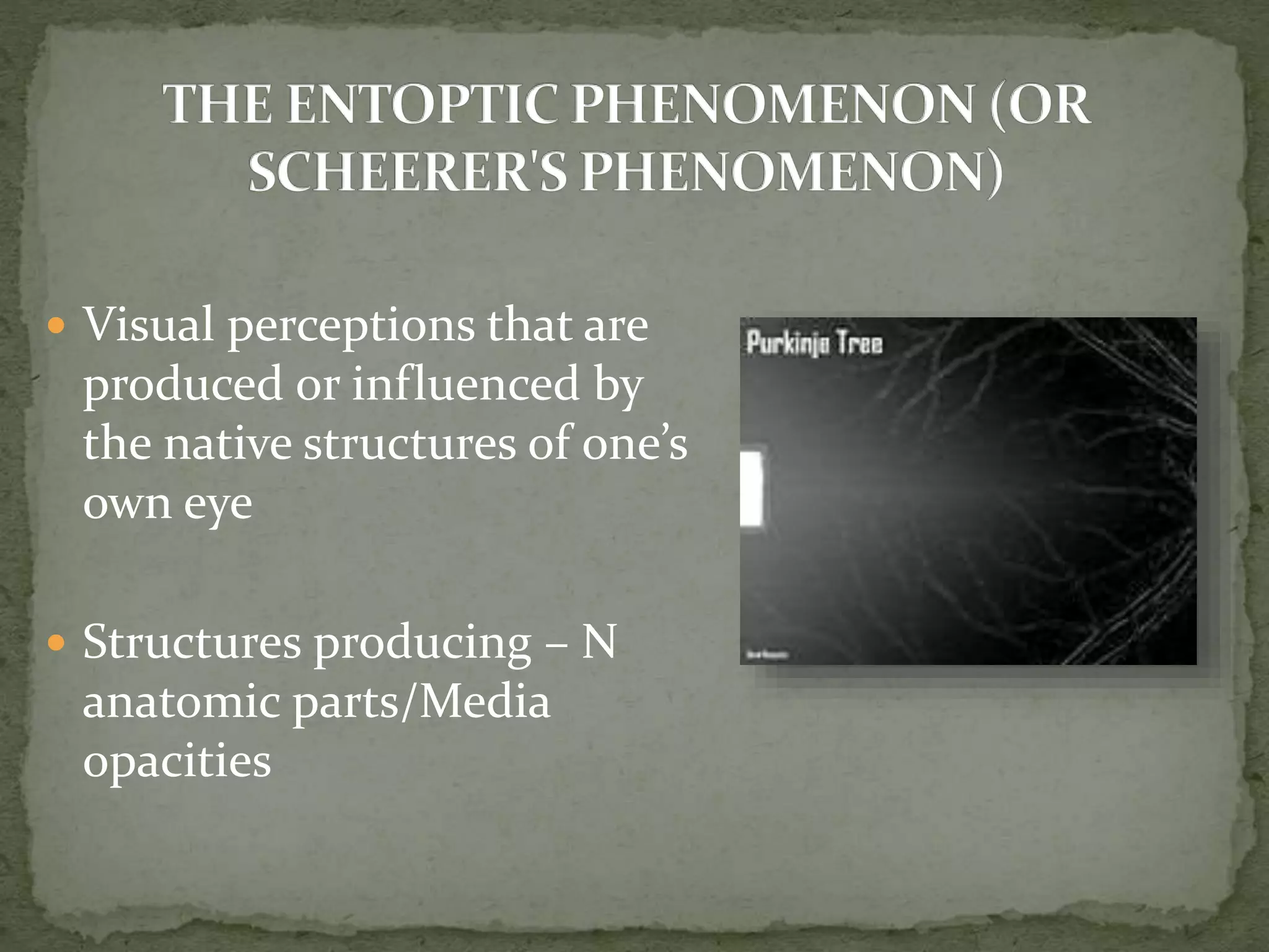  Visual perceptions that are
produced or influenced by
the native structures of one’s
own eye
 Structures producing – N
anatomic parts/Media
opacities
 