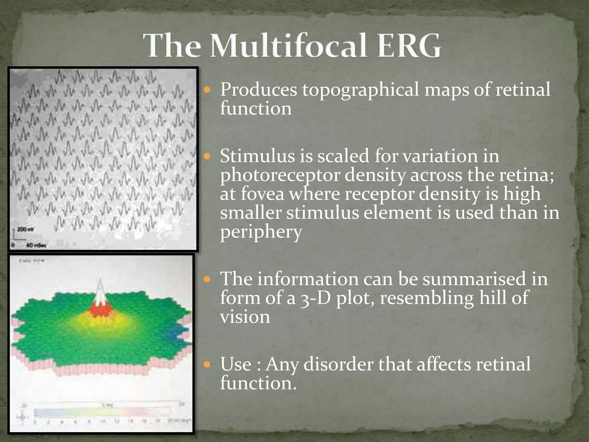  Produces topographical maps of retinal
function
 Stimulus is scaled for variation in
photoreceptor density across the retina;
at fovea where receptor density is high
smaller stimulus element is used than in
periphery
 The information can be summarised in
form of a 3-D plot, resembling hill of
vision
 Use : Any disorder that affects retinal
function.
 