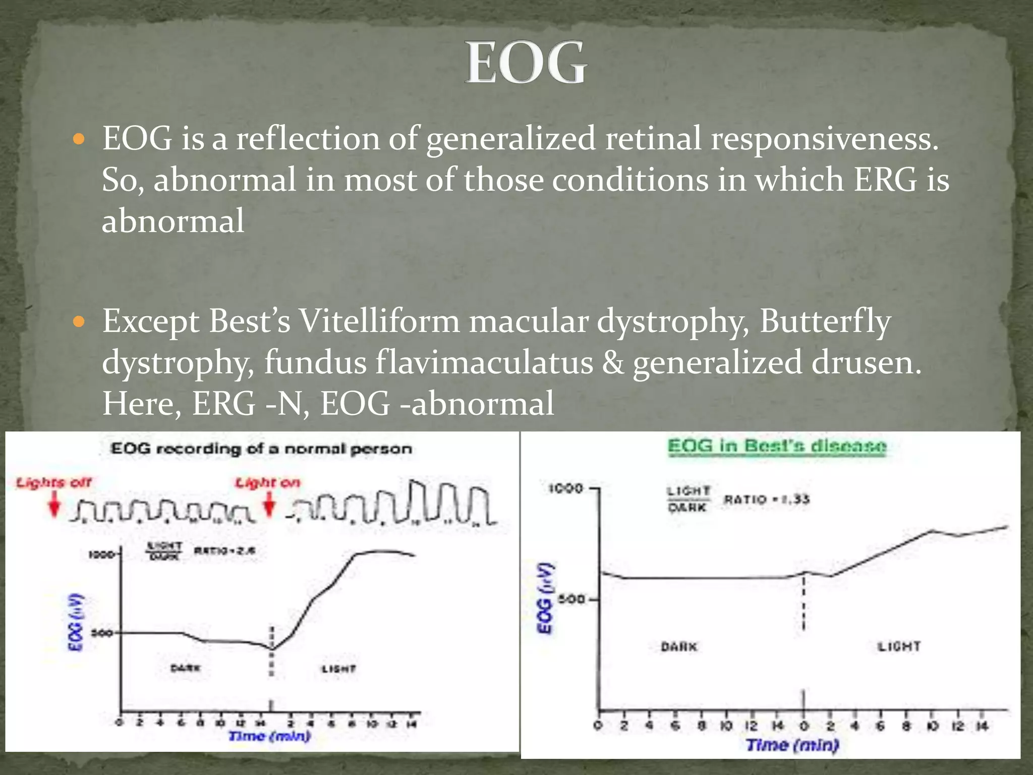  EOG is a reflection of generalized retinal responsiveness.
So, abnormal in most of those conditions in which ERG is
abnormal
 Except Best’s Vitelliform macular dystrophy, Butterfly
dystrophy, fundus flavimaculatus & generalized drusen.
Here, ERG -N, EOG -abnormal
 