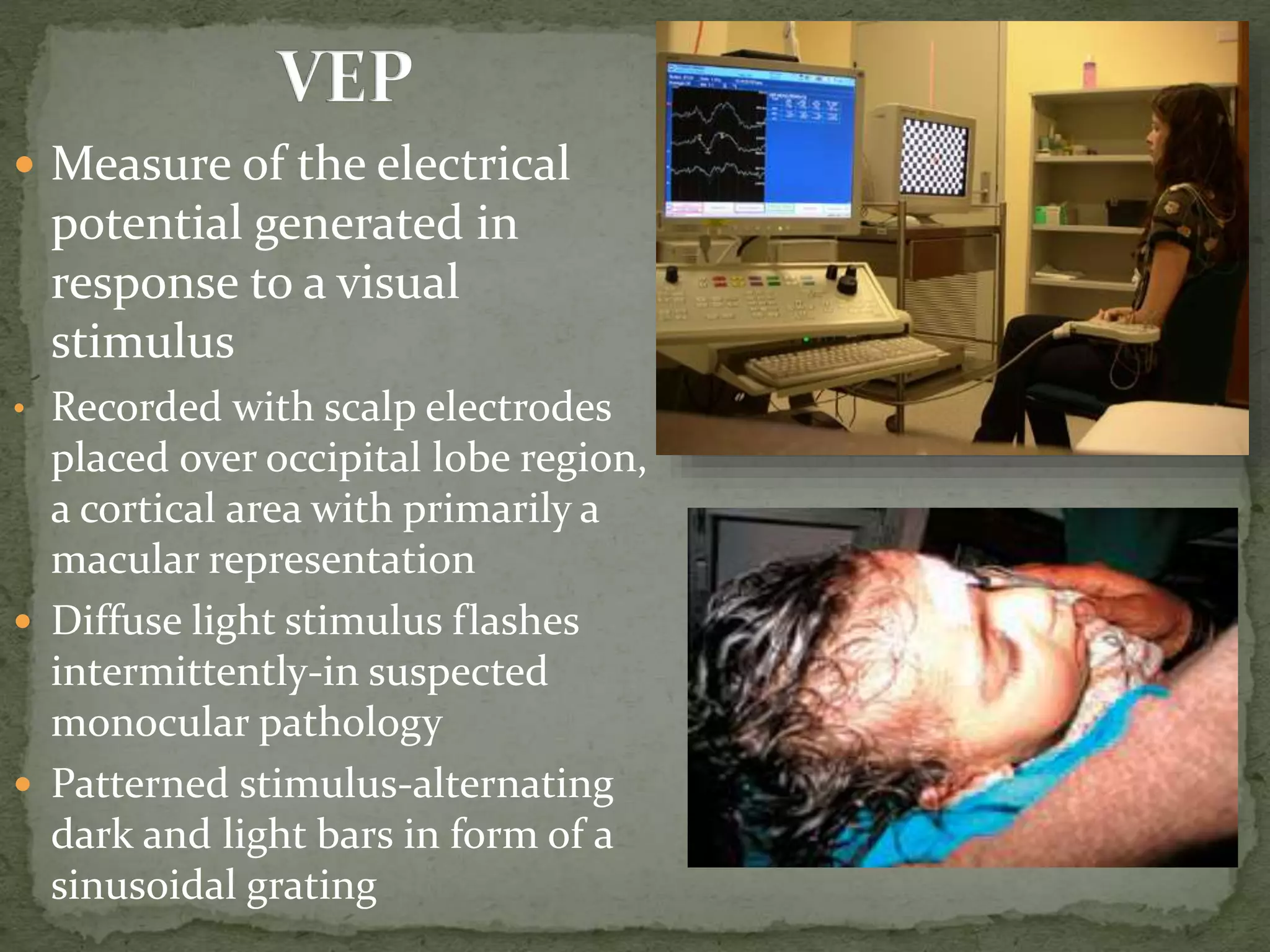  Measure of the electrical
potential generated in
response to a visual
stimulus
• Recorded with scalp electrodes
placed over occipital lobe region,
a cortical area with primarily a
macular representation
 Diffuse light stimulus flashes
intermittently-in suspected
monocular pathology
 Patterned stimulus-alternating
dark and light bars in form of a
sinusoidal grating
 