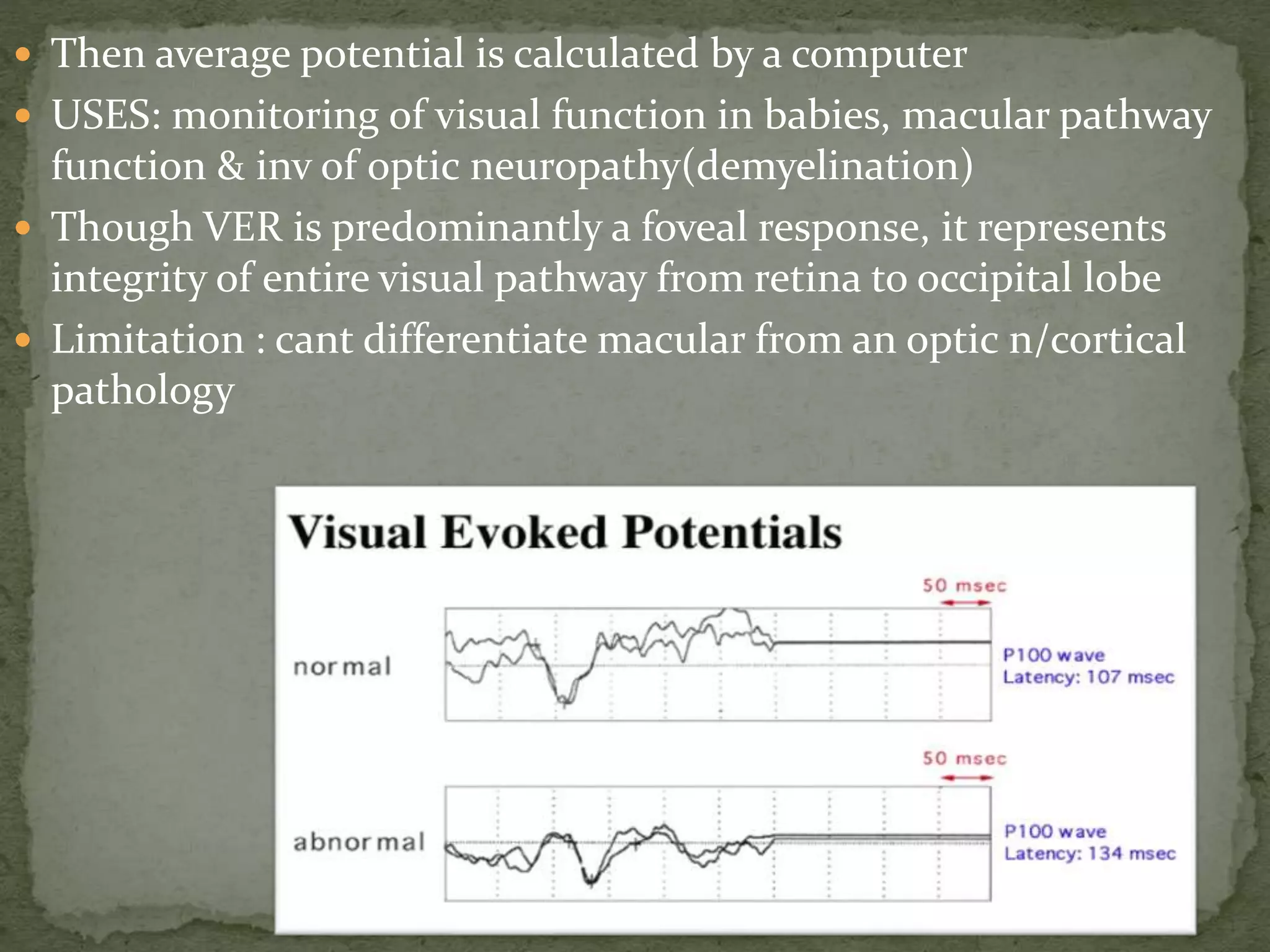  Then average potential is calculated by a computer
 USES: monitoring of visual function in babies, macular pathway
function & inv of optic neuropathy(demyelination)
 Though VER is predominantly a foveal response, it represents
integrity of entire visual pathway from retina to occipital lobe
 Limitation : cant differentiate macular from an optic n/cortical
pathology
 