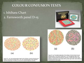 1. Ishihara Chart
2. Farnsworth panel D-15
 