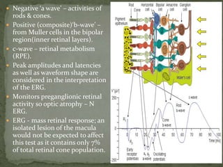  Negative ‘a wave’ – activities of
rods & cones.
 Positive (composite)‘b-wave’ –
from Muller cells in the bipolar
region(inner retinal layers).
 c-wave – retinal metabolism
(RPE).
 Peak amplitudes and latencies
as well as waveform shape are
considered in the interpretation
of the ERG.
 Monitors preganglionic retinal
activity so optic atrophy – N
ERG.
 ERG - mass retinal response; an
isolated lesion of the macula
would not be expected to affect
this test as it contains only 7%
of total retinal cone population.
 