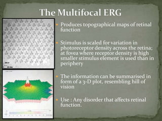  Produces topographical maps of retinal
function
 Stimulus is scaled for variation in
photoreceptor density across the retina;
at fovea where receptor density is high
smaller stimulus element is used than in
periphery
 The information can be summarised in
form of a 3-D plot, resembling hill of
vision
 Use : Any disorder that affects retinal
function.
 