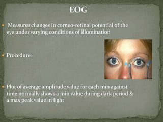  Measures changes in corneo-retinal potential of the
eye under varying conditions of illumination
 Procedure
 Plot of average amplitude value for each min against
time normally shows a min value during dark period &
a max peak value in light
 