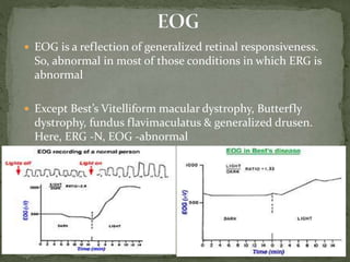  EOG is a reflection of generalized retinal responsiveness.
So, abnormal in most of those conditions in which ERG is
abnormal
 Except Best’s Vitelliform macular dystrophy, Butterfly
dystrophy, fundus flavimaculatus & generalized drusen.
Here, ERG -N, EOG -abnormal
 