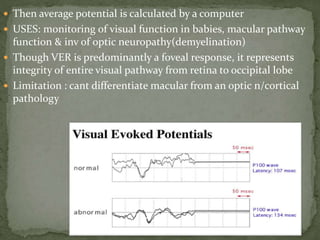  Then average potential is calculated by a computer
 USES: monitoring of visual function in babies, macular pathway
function & inv of optic neuropathy(demyelination)
 Though VER is predominantly a foveal response, it represents
integrity of entire visual pathway from retina to occipital lobe
 Limitation : cant differentiate macular from an optic n/cortical
pathology
 