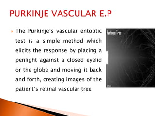 The Purkinje’s vascular entoptic
test is a simple method which
elicits the response by placing a
penlight against a closed eyelid
or the globe and moving it back
and forth, creating images of the
patient’s retinal vascular tree
 