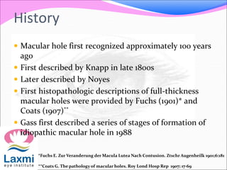 History
 Macular hole first recognized approximately 100 years
ago
 First described by Knapp in late 1800s
 Later described by Noyes
 First histopathologic descriptions of full-thickness
macular holes were provided by Fuchs (1901)* and
Coats (1907)**
 Gass first described a series of stages of formation of
idiopathic macular hole in 1988
*Fuchs E. Zur Veranderung der Macula Lutea Nach Contusion. Ztschr Augenheilk 1901;6:181
**Coats G. The pathology of macular holes. Roy Lond Hosp Rep 1907; 17-69
 