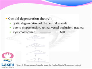  Cystoid degeneration theory*:
 cystic degeneration of the central macula
 due to :hypertension, retinal vessel occlusion, trauma
 Cyst coalescence FTMH
*Coats G. The pathology of macular holes. Roy London Hospital Report 1907; 17:69-96
 