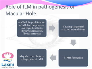 Role of ILM in pathogenesis of
Macular Hole
scaffold for proliferation
of cellular components
Like myofibroblasts,
fibrocytes,RPE cells,
fibrous astrocyts
Causing tangential
traction around fovea
FTMH formation
May also contribute to
enlargement of MH
 
