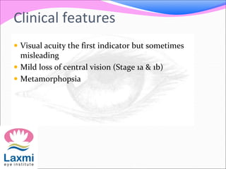 Clinical features
 Visual acuity the first indicator but sometimes
misleading
 Mild loss of central vision (Stage 1a & 1b)
 Metamorphopsia
 