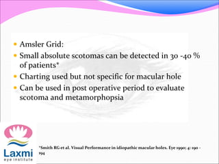 Amsler Grid:
 Small absolute scotomas can be detected in 30 -40 %
of patients*
 Charting used but not specific for macular hole
 Can be used in post operative period to evaluate
scotoma and metamorphopsia
*Smith RG et al. Visual Performance in idiopathic macular holes. Eye 1990; 4: 190 -
194
 