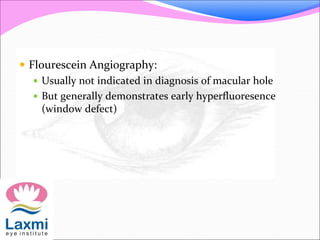  Flourescein Angiography:
 Usually not indicated in diagnosis of macular hole
 But generally demonstrates early hyperfluoresence
(window defect)
 