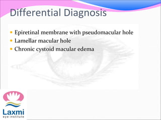 Differential Diagnosis
 Epiretinal membrane with pseudomacular hole
 Lamellar macular hole
 Chronic cystoid macular edema
 