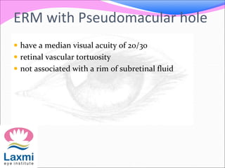ERM with Pseudomacular hole
 have a median visual acuity of 20/30
 retinal vascular tortuosity
 not associated with a rim of subretinal fluid
 