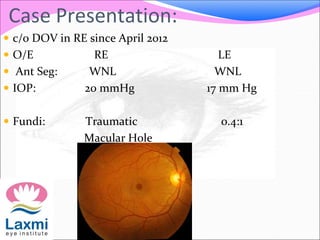Case Presentation:
 c/o DOV in RE since April 2012
 O/E RE LE
 Ant Seg: WNL WNL
 IOP: 20 mmHg 17 mm Hg
 Fundi: Traumatic 0.4:1
Macular Hole
 