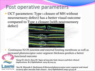 Post operative parameters
 OCT parameters: Type 1 closure of MH without
neurosensory defect) has a better visual outcome
compared to Type 2 closure (with neurosensory
defect)
 Continuous IS/OS junction and external limiting membrane as well as
increased photoreceptor outer segment thickness predicts a better
functional outcome
1Kang ST, Ahn K, Ham DI. Types of macular hole closure and their clinical
implications. Br J Ophthalmol. 2003; 87:1015-19
2San M, Shimoda Y, Hashimoto H.Restored photoreceptor outer segment and visual
recovery after macular hole closure . Am J Ophthalmol 2009; 147:313-18
 