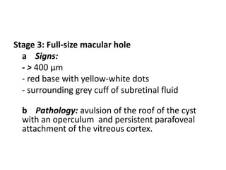 Stage 3: Full-size macular hole
a Signs:
- > 400 µm
- red base with yellow-white dots
- surrounding grey cuff of subretinal fluid
b Pathology: avulsion of the roof of the cyst
with an operculum and persistent parafoveal
attachment of the vitreous cortex.
 